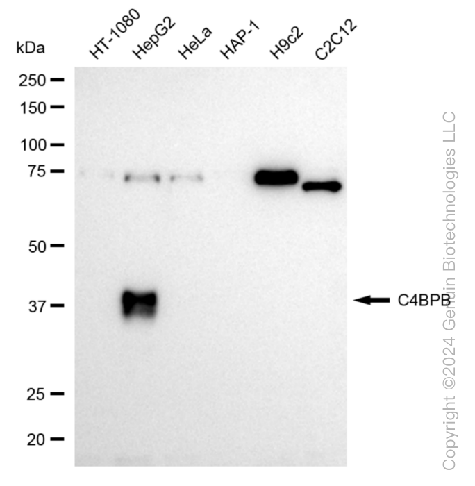 WB - KD-Validated Anti-C4BPB Rabbit Monoclonal Antibody AGI1018