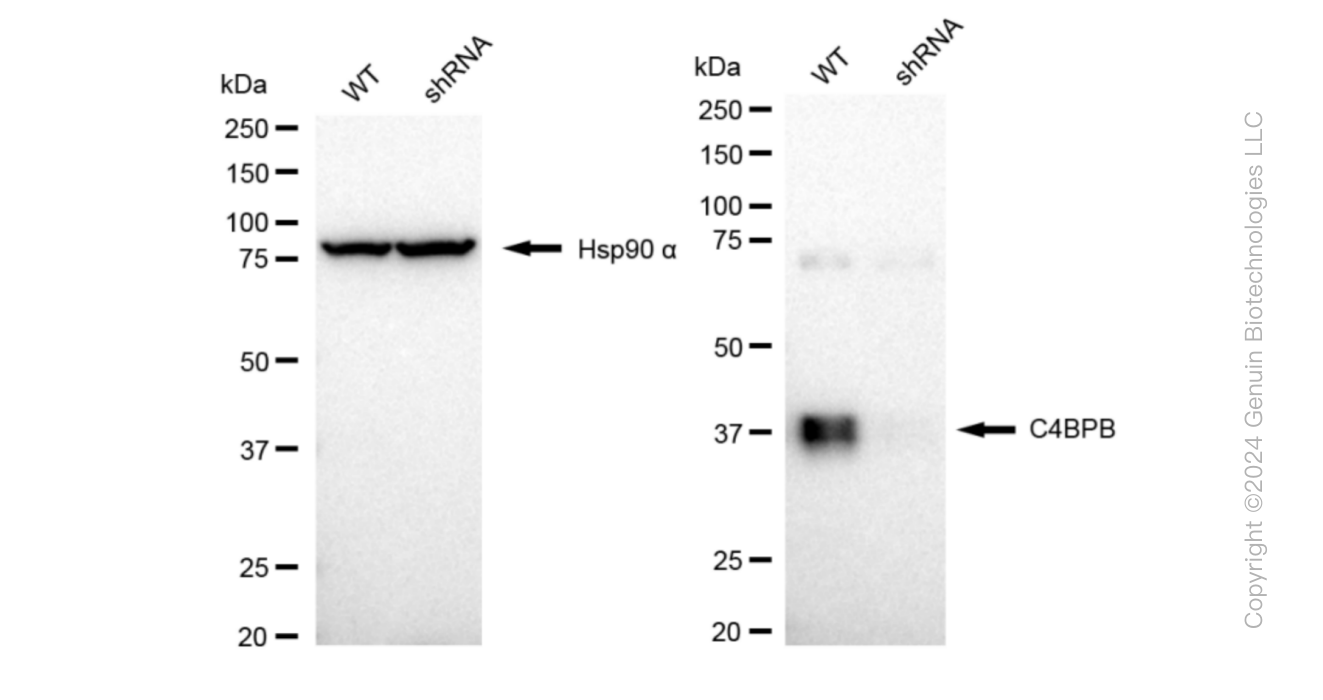 WB - KD-Validated Anti-C4BPB Rabbit Monoclonal Antibody AGI1018