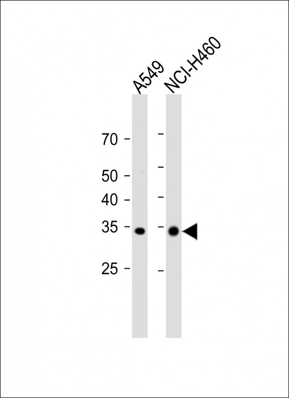 WB - FAM26F Antibody (C-term) AP20331b
