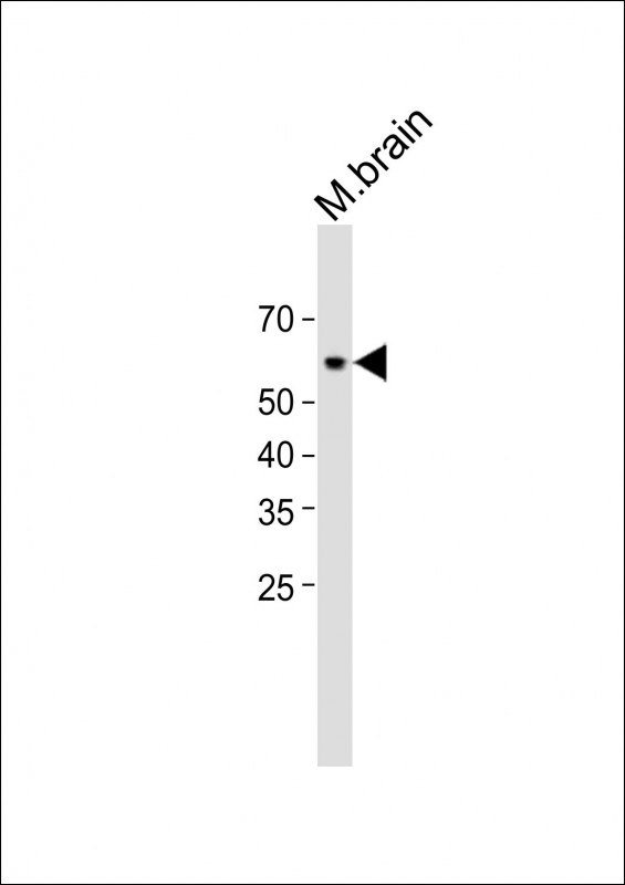 WB - AKT3(S472) Antibody AP22487a
