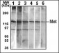 MET/HGFR Antibody