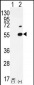 PRMT2 Antibody (N-term)