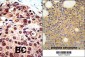PRMT3 Antibody (C-term)