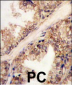 PRMT4 Antibody (C-term)