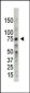 PRMT5 Antibody (C-term)