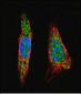 SUMO1 Antibody (N-term)