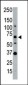 SENP1 Antibody (N-term)