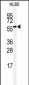 SENP2 Antibody (C-term)