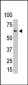 PIAS2 (PIASx1/2) Antibody (N-term)