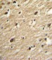 PIASy1 Antibody (C-term)