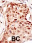 CBLC Antibody (C-term)
