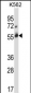 CBLC Antibody (C-term)