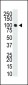 Dnmt3a Antibody