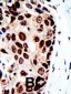 HDAC9 Antibody (C-term)