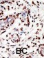 HRX Antibody (C-term)