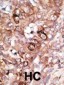 Bad BH3 Domain Antibody