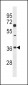 DKK2 Antibody (C-term)