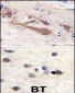 VILIP1 Antibody (C-term)