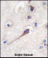 Hippocalcin Antibody (N-term)