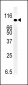 SMURF1 Antibody (N-term)