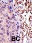 UBE2L3 Antibody (N-term)