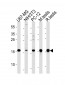 UBE2L3 Antibody (C-term)