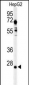 UCHL3 Antibody (C-term)