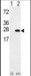 UCHL3 Antibody (C-term)