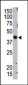 TSG101 Antibody (C-term)