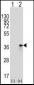 TOLLIP Antibody (C-term)