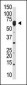 NYREN18 Antibody (N-term)