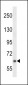 NYREN18 Antibody (N-term)