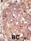 NYREN18 Antibody (C-term)