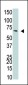 NYREN18 Antibody (C-term)