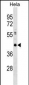 CBX8 Antibody (C-term)