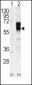 ACVRL1 Antibody (N-term)