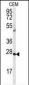 AK2 Antibody (N-term)