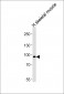 Fructose 6 Phosphate Kinase Antibody (N-term)