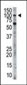 HK3 (Hexokinase III) Antibody (C-term)