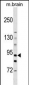 HK3 (Hexokinase III) Antibody (C-term)