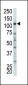 HK2 (Hexokinase II) Antibody (Center)