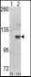 HK1 (Hexokinase) Antibody (N-term)