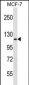 HK1 (Hexokinase) Antibody (N-term)