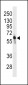 PFKFB3 Antibody (C-term)