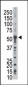 PFKFB2 Antibody (C-term)