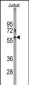 PFKFB1 Antibody (N-term)