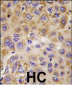 PFKFB1 Antibody (Center)