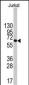 PFKFB1 Antibody (Center)