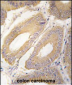 FGF4 Antibody (C-term)