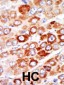 AK1 Antibody (C-term)